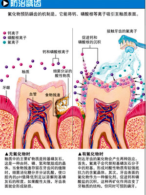 含氟的牙膏好与否？