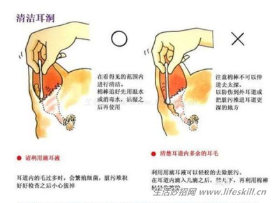 减少狗狗身上难闻的“体味”，从这三个地方入手。