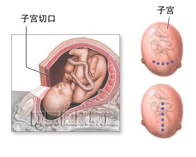 急产病人的急救处理