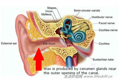 挖耳朵的小知识。看完专家说明，再也不敢乱挖了！
