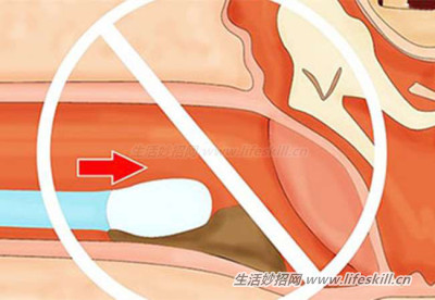 挖耳朵的小知识。看完专家说明，再也不敢乱挖了！